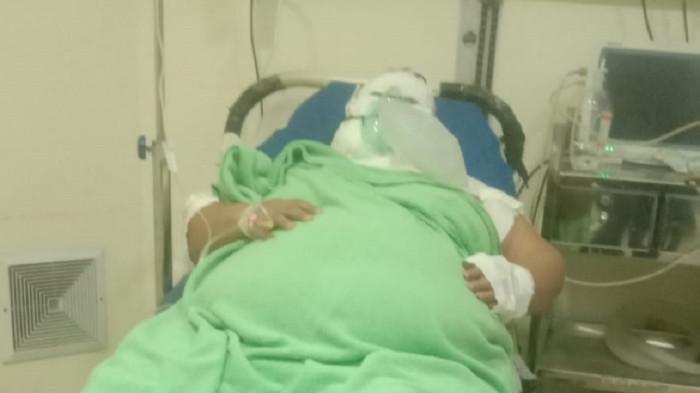 istri-dibakar-suami-di-Jatinegara24